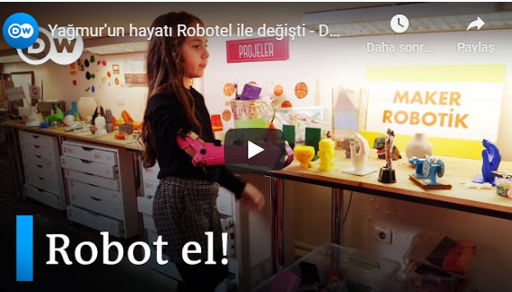 Robotel Türkiye’nin ilk vakalarından, göz bebeğimiz Yağmur’dan teknolojinin insan hayatına dokunan hikayesini @ozanonat aracılığıyla @dw_turkce videosunda izlemek, tebessümüne eşlik etmek ister misiniz? #SosyalFayda için #Teknoloji #3dprint #Robotel